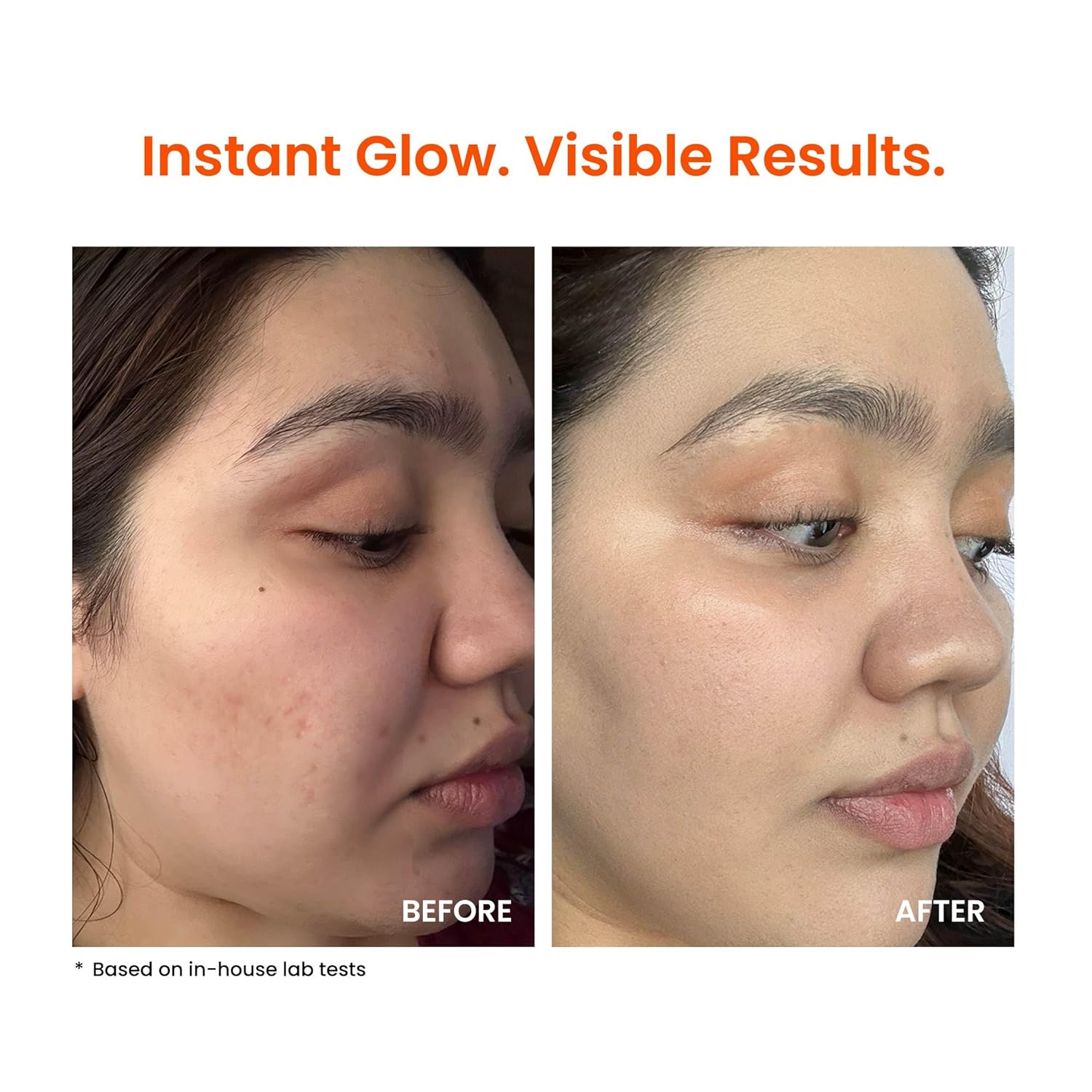 Foxtale Super Glow Moisturiser |  Vitamin C +Niacinamide +Squalane 50 ml