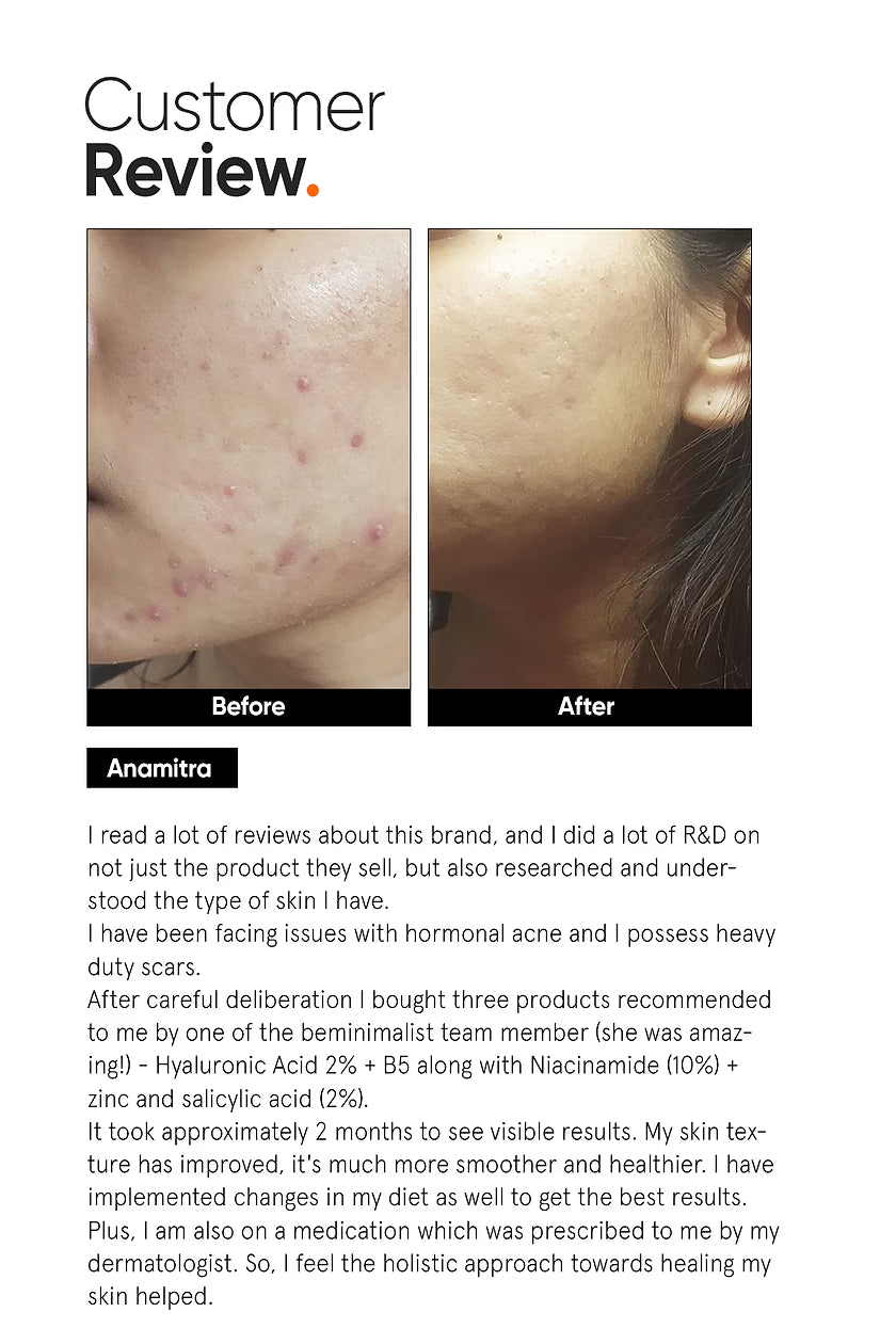 Minimalist Hyaluronic + PGA 2% Face Serum | Deep Hydration & Plumping Serum | 30ml