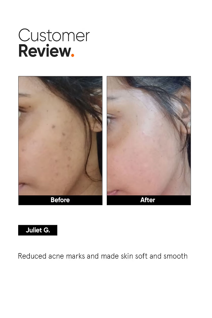 Minimalist Niacinamide 5% Face Serum | 30ml